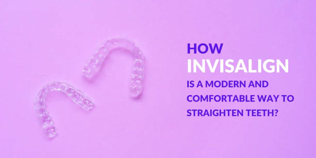 How Invisalign is a modern and comfortable way to straighten teeth?