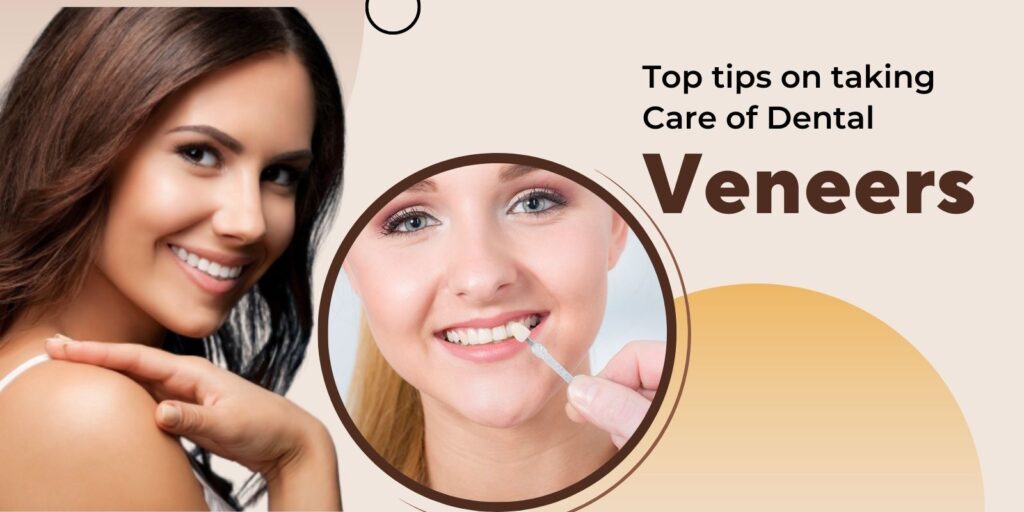 Top Tips on Taking Care of Dental Veneers