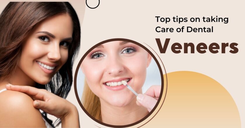 Top Tips on Taking Care of Dental Veneers